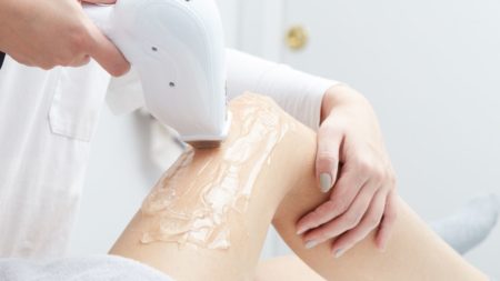 laser hair removal on legs